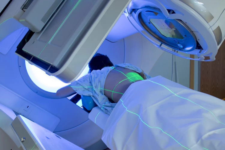 Radiation therapy patient receiving laser treatment (stock image)