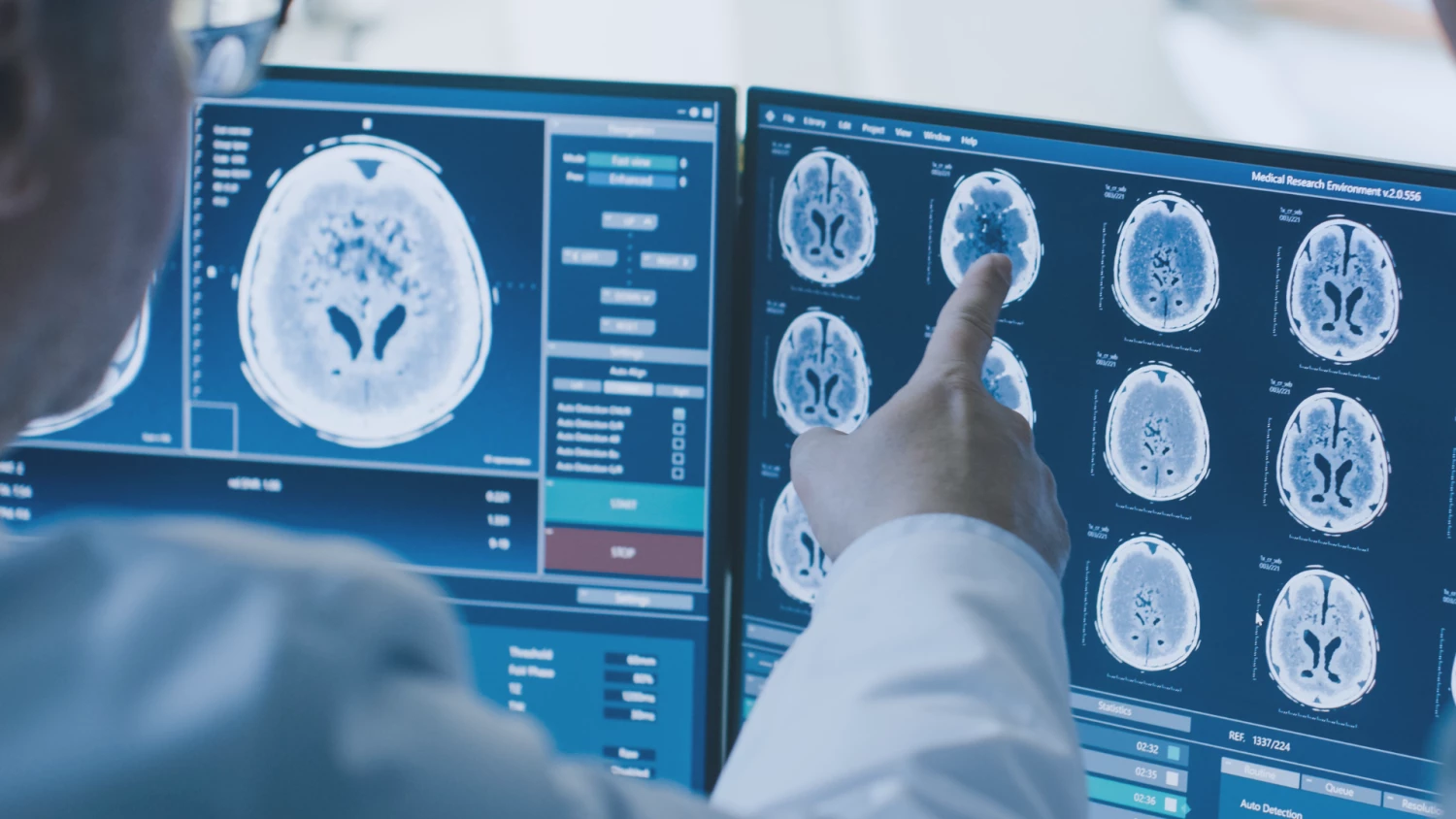 radiologist analysing